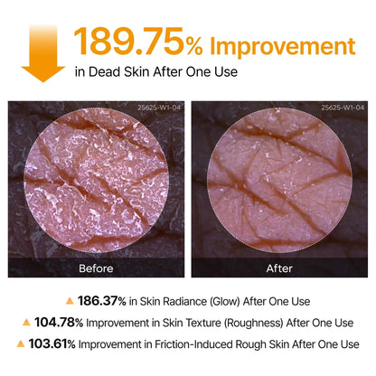 Acidic Turmeric Exfoliating Cleansing Spray Scrub