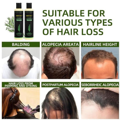 🔥LAST DAY 50% OFF - Organic Rosemary Hair Growth Shampoo
